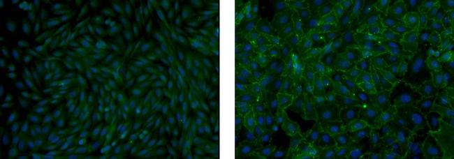 Mouse IgM Isotype Control in Immunocytochemistry (ICC/IF)