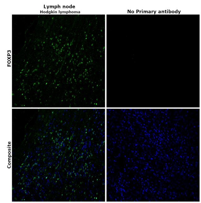 FOXP3 Antibody in Immunohistochemistry (Paraffin) (IHC (P))