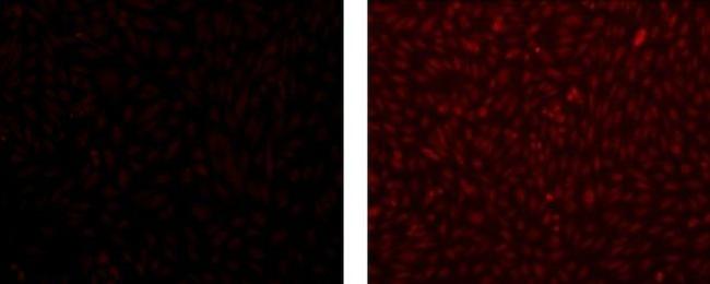 MASH1 Antibody in Immunocytochemistry (ICC/IF)