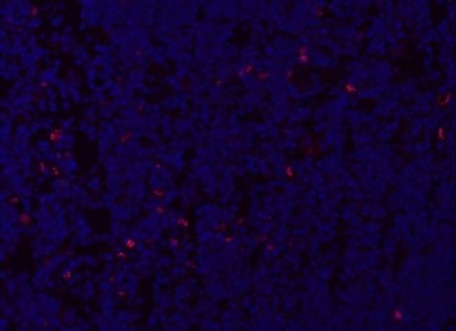 AIRE Antibody in Immunohistochemistry (Frozen) (IHC (F))