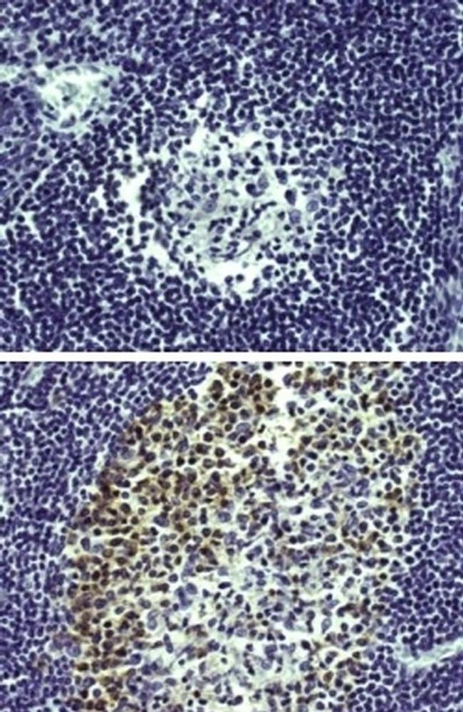 AID Antibody in Immunohistochemistry (Paraffin) (IHC (P))