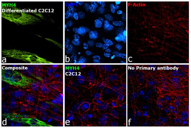 Myosin 4 Antibody in Immunocytochemistry (ICC/IF)