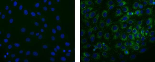 STRO-1 Antibody in Immunocytochemistry (ICC/IF)