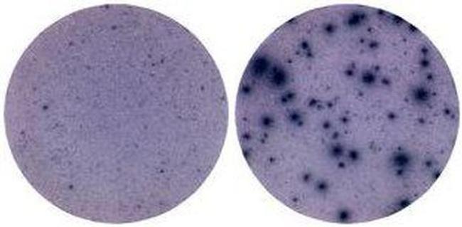 IFN gamma Antibody in Immunostaining (IS)