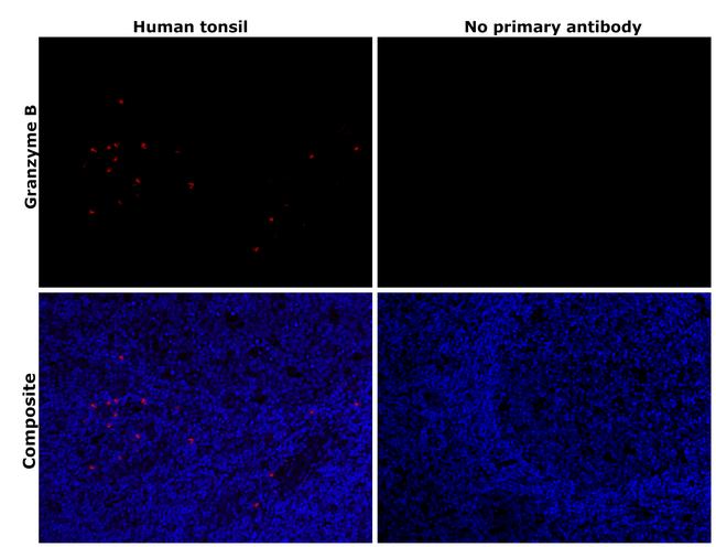 Granzyme B Antibody in Immunohistochemistry (Paraffin) (IHC (P))