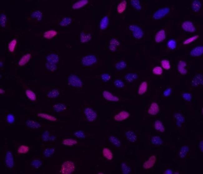 Phospho-ATM (Ser1981) Antibody in Immunocytochemistry (ICC/IF)