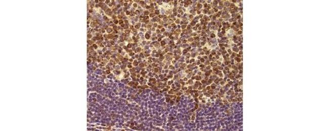 MCL-1 Antibody in Immunohistochemistry (Paraffin) (IHC (P))