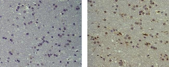 TAL-1 Antibody in Immunohistochemistry (Paraffin) (IHC (P))