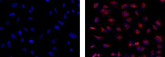 EEA1 Antibody in Immunocytochemistry (ICC/IF)