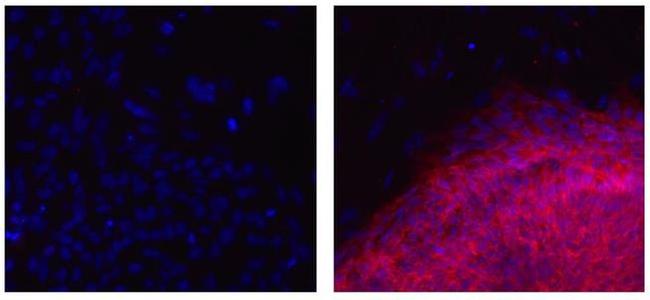 NLGN4X (Neuroligin-4) Antibody in Immunocytochemistry (ICC/IF)