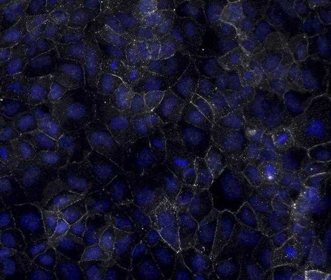 Desmoglein 2 Antibody in Immunocytochemistry (ICC/IF)