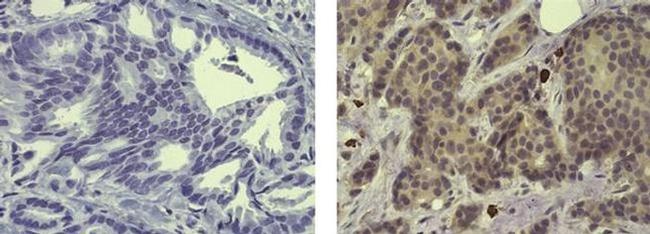 Estrogen Receptor beta Antibody in Immunohistochemistry (Paraffin) (IHC (P))