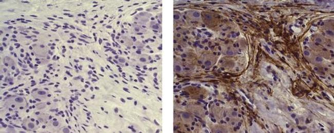 CD271 (NGF Receptor) Antibody in Immunohistochemistry (Paraffin) (IHC (P))