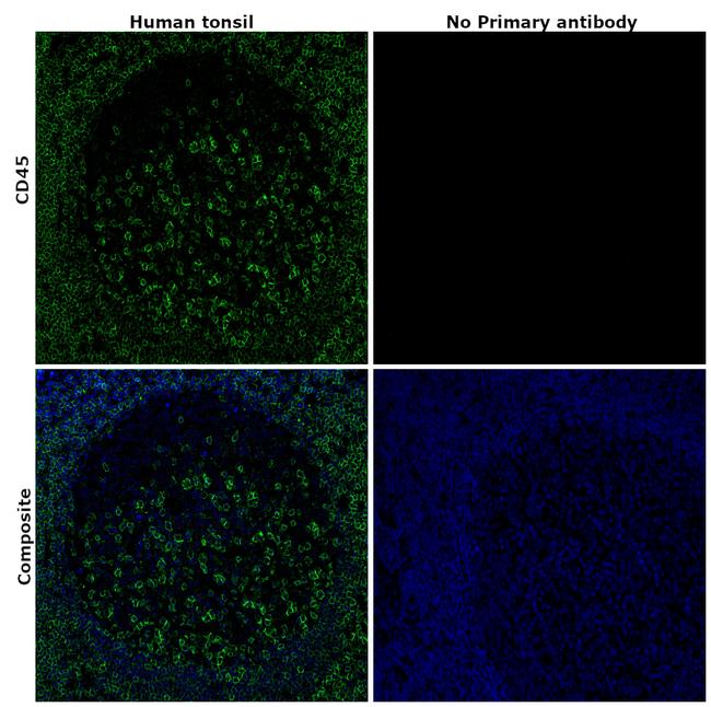 CD45 Antibody in Immunohistochemistry (Paraffin) (IHC (P))