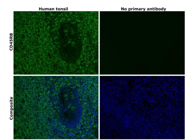 CD45RB Antibody in Immunohistochemistry (Paraffin) (IHC (P))