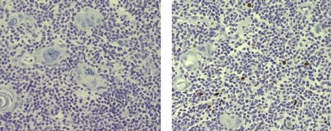 AIRE Antibody in Immunohistochemistry (Paraffin) (IHC (P))