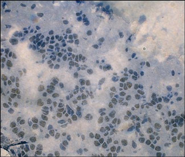 HCN2 Antibody in Immunohistochemistry (Frozen) (IHC (F))