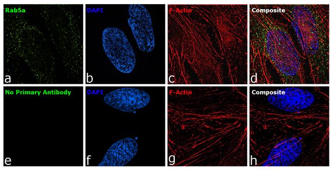 RAB5A Antibody in Immunocytochemistry (ICC/IF)