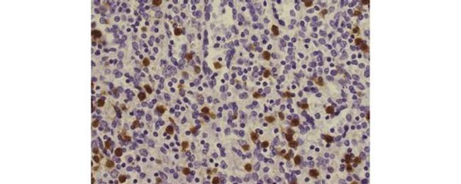 S100A8 Antibody in Immunohistochemistry (Paraffin) (IHC (P))