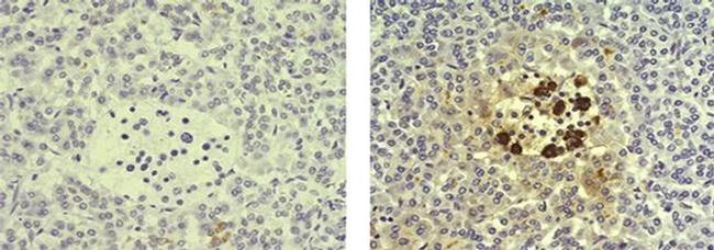 Somatostatin Antibody in Immunohistochemistry (Paraffin) (IHC (P))