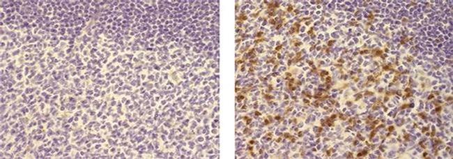 ITK Antibody in Immunohistochemistry (Paraffin) (IHC (P))