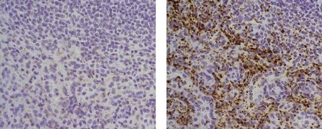 Thrombospondin-1 Antibody in Immunohistochemistry (Paraffin) (IHC (P))