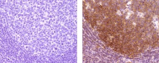 HGAL Antibody in Immunohistochemistry (Paraffin) (IHC (P))