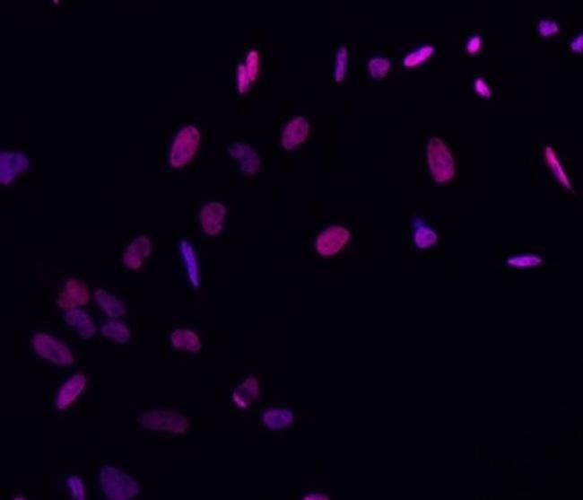 Brachyury Antibody in Immunocytochemistry (ICC/IF)