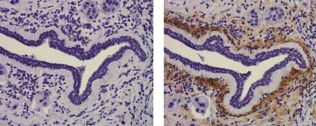 Collagen X Antibody in Immunohistochemistry (Paraffin) (IHC (P))