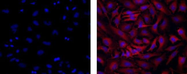 Dynein Antibody in Immunocytochemistry (ICC/IF)