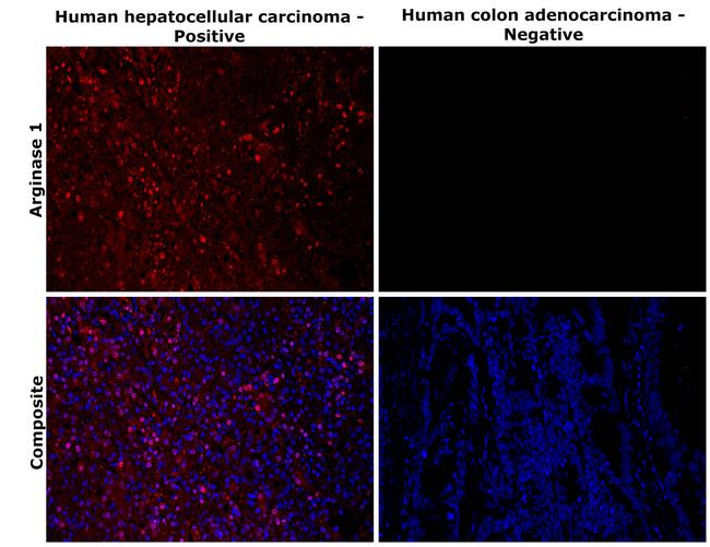 Arginase 1 Antibody in Immunohistochemistry (Paraffin) (IHC (P))