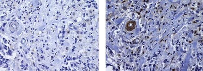 PU.1 Antibody in Immunohistochemistry (Paraffin) (IHC (P))