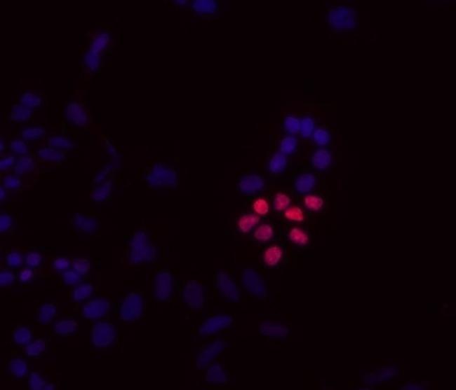 UTF1 Antibody in Immunocytochemistry (ICC/IF)