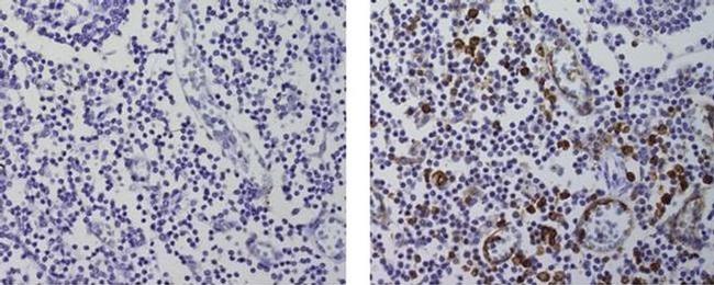 Cutaneous Lymphocyte Antigen (CLA) Antibody in Immunohistochemistry (Paraffin) (IHC (P))