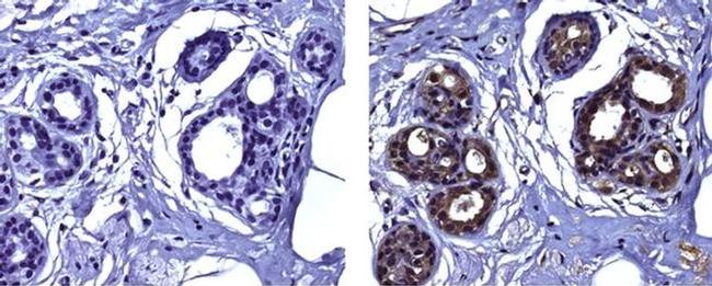 Snail1 Antibody in Immunohistochemistry (Paraffin) (IHC (P))