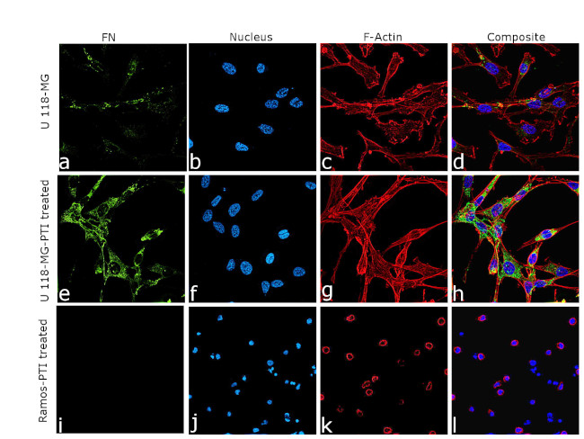 Fibronectin Antibody in Immunocytochemistry (ICC/IF)