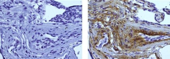 Collagen IV Antibody in Immunohistochemistry (Paraffin) (IHC (P))