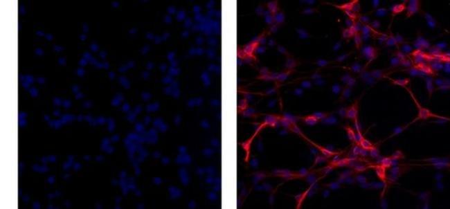 GFAP Antibody in Immunocytochemistry (ICC/IF)