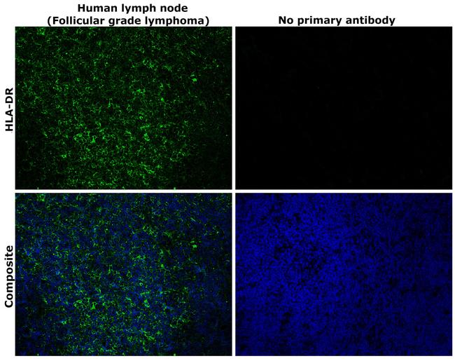 HLA-DR Antibody in Immunohistochemistry (Paraffin) (IHC (P))