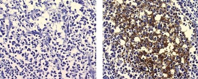 FDC Antibody in Immunohistochemistry (Paraffin) (IHC (P))