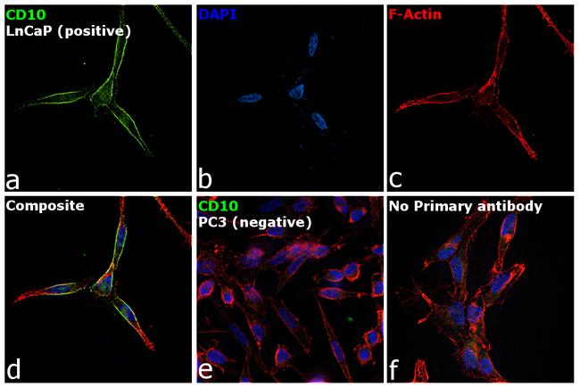 CD10 Antibody in Immunocytochemistry (ICC/IF)