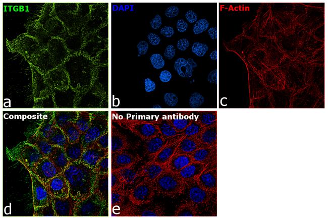 CD29 (Integrin beta 1) Antibody in Immunocytochemistry (ICC/IF)