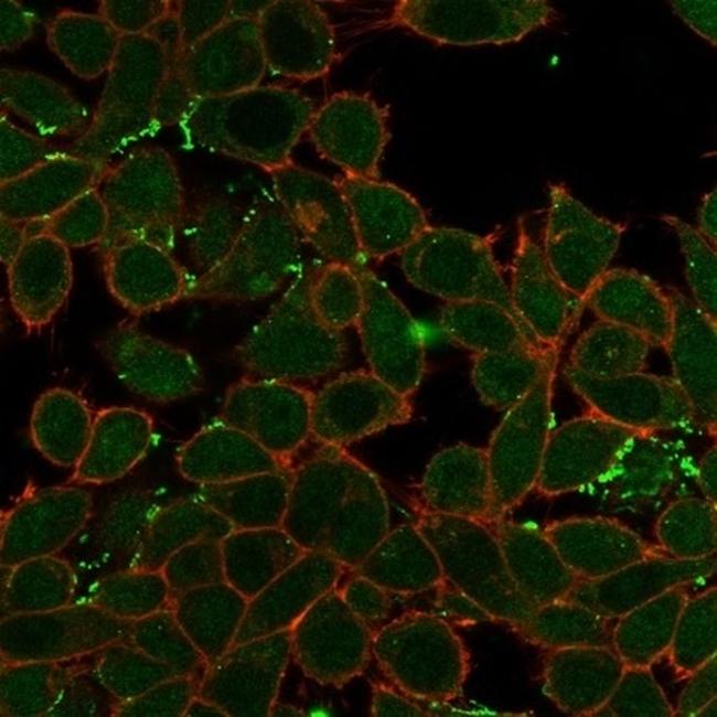 ZNF358 (Zinc Finger Protein 358) (Transcription Factor) Antibody in Immunocytochemistry (ICC/IF)