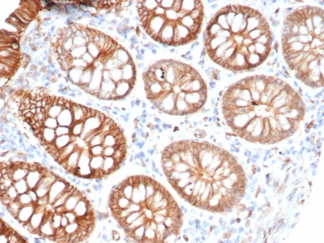 S100A16 (S100 calcium binding protein A16) Antibody in Immunohistochemistry (Paraffin) (IHC (P))