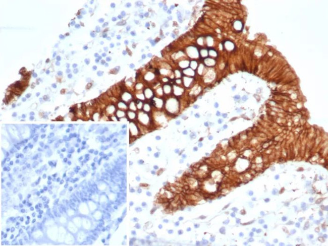 S100A16 (S100 calcium binding protein A16) Antibody in Immunohistochemistry (Paraffin) (IHC (P))