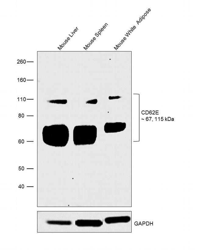 CD62E (E-selectin) Antibody in Western Blot (WB)