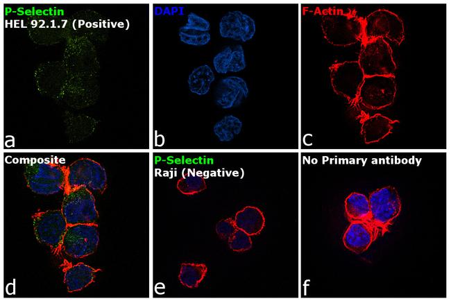 CD62P (P-Selectin) Antibody in Immunocytochemistry (ICC/IF)