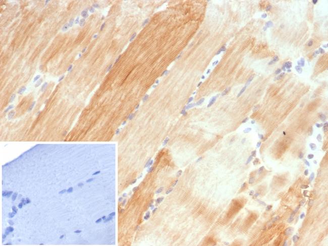 Crystallin Alpha B Antibody in Immunohistochemistry (Paraffin) (IHC (P))