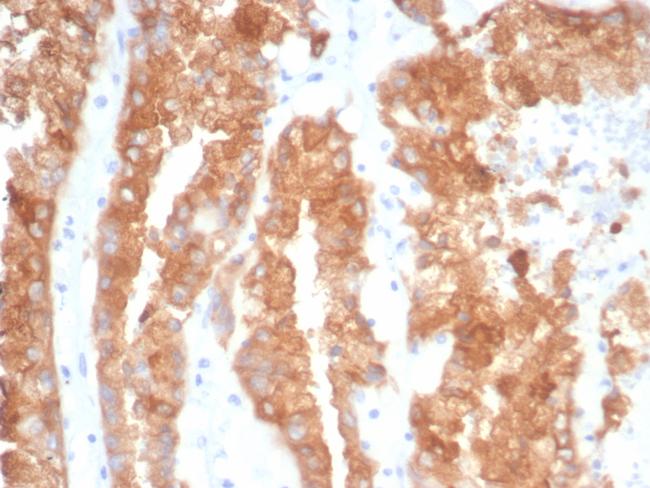 Crystallin Alpha B Antibody in Immunohistochemistry (Paraffin) (IHC (P))