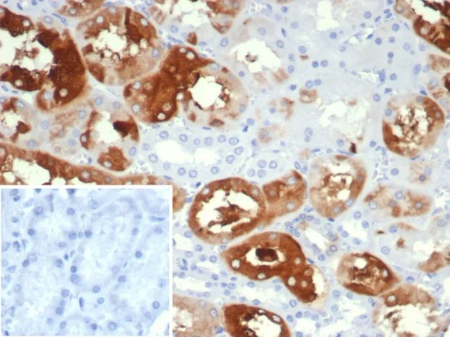 Crystallin Alpha B Antibody in Immunohistochemistry (Paraffin) (IHC (P))